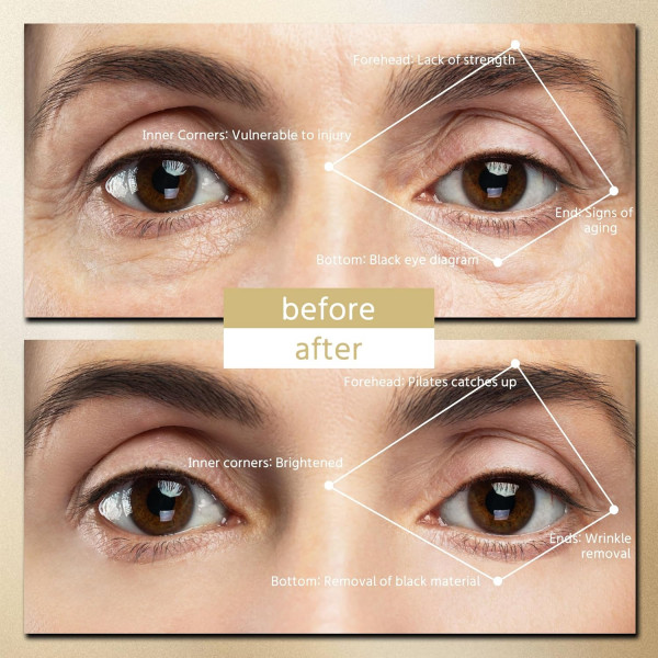 Міні-пристрій для догляду за очима DYM058 з терапією червоним світлом та EMS