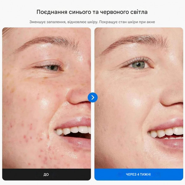 LED маска для обличчя BM-43 зі світлотерапією 7 кольорів, 88 LED і регулювання яскравості