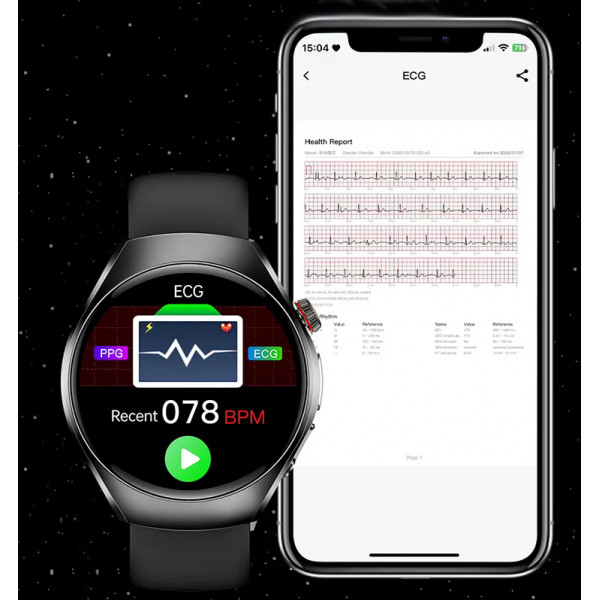 Смарт-часы Lemfo ET460 с измерением давления ЭКГ и Bluetooth-звонками