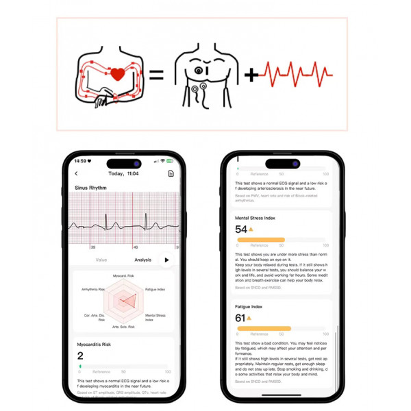 Смарт-часы Lemfo ET491 с ЭКГ функцией звонков и управлением камерой